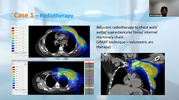 NorDocs webinar